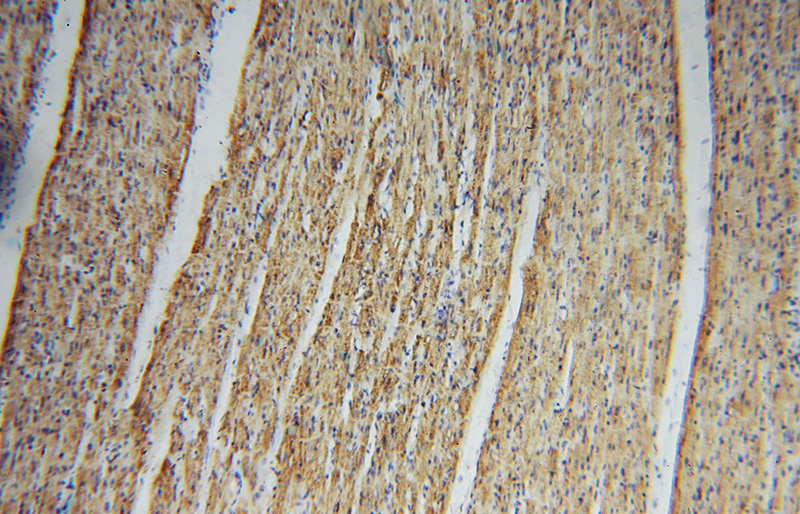 Immunohistochemical of paraffin-embedded human heart using Catalog No:109325(CS antibody) at dilution of 1:100 (under 10x lens)