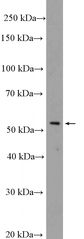 HeLa cells were subjected to SDS PAGE followed by western blot with Catalog No:109833(DDX49 Antibody) at dilution of 1:600