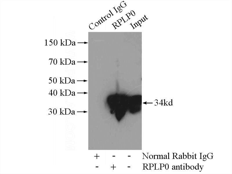 IP Result of anti-RPLP0 (IP:Catalog No:114905, 4ug; Detection:Catalog No:114905 1:500) with HeLa cells lysate 4000ug.