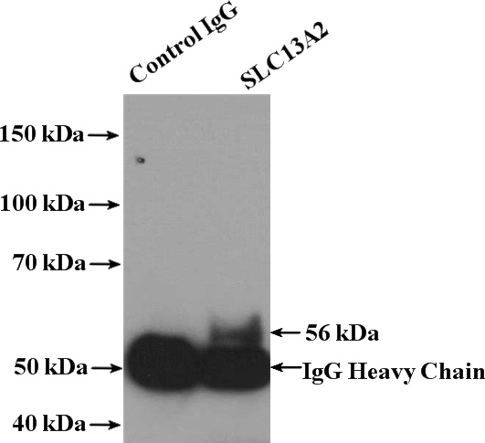 IP Result of anti-SLC13A2 (IP:Catalog No:115301, 4ug; Detection:Catalog No:115301 1:300) with mouse kidney tissue lysate 4000ug.