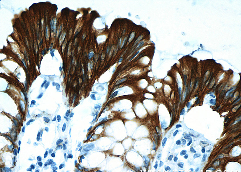 Immunohistochemistry of paraffin-embedded human colon tissue slide using Catalog No:107233(KRT20 Antibody) at dilution of 1:400 (under 40x lens). Heat mediated antigen retrieved with Citric acid buffer, pH6.0