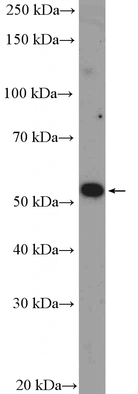 Jurkat cells were subjected to SDS PAGE followed by western blot with Catalog No:109436(CNOT6 Antibody) at dilution of 1:300