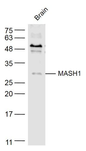 Fig2: Sample:; Brain (Mouse) Lysate at 40 ug; Primary: Anti-MASH1 at 1/300 dilution; Secondary: IRDye800CW Goat Anti-Rabbit IgG at 1/20000 dilution; Predicted band size: 26 kD; Observed band size: 26 kD