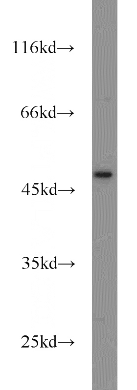 Jurkat cells were subjected to SDS PAGE followed by western blot with Catalog No:109642(CXCR1 antibody) at dilution of 1:300