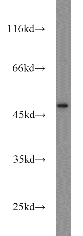 Jurkat cells were subjected to SDS PAGE followed by western blot with Catalog No:109642(CXCR1 antibody) at dilution of 1:300