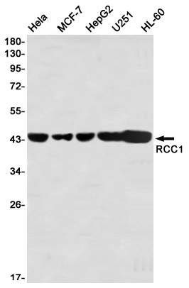 Western blot detection of RCC1 in Hela,MCF-7,HepG2,U251,HL-60 using RCC1 Rabbit mAb(1:1000 diluted)