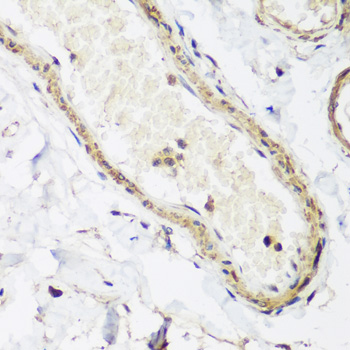 Immunohistochemistry - CAV3 Polyclonal Antibody 