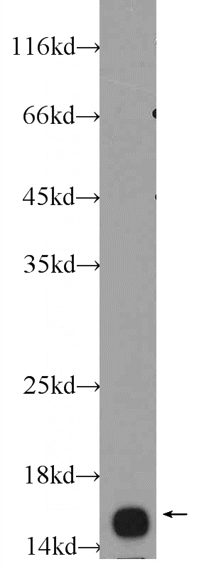 L02 cells were subjected to SDS PAGE followed by western blot with Catalog No:116516(UBE2B Antibody) at dilution of 1:600