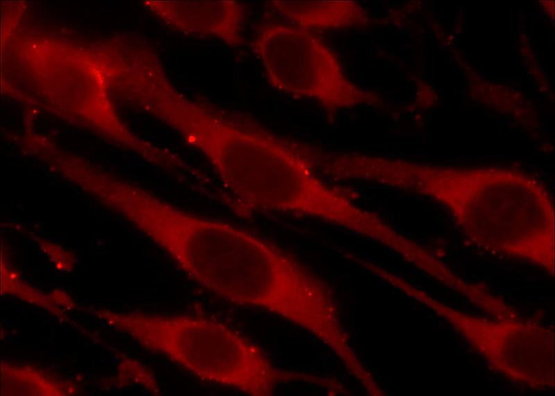 Immunofluorescent analysis of C6 cells using Catalog No:107063(APOBEC3G Antibody) at dilution of 1:25 and Rhodamine-Goat anti-Mouse IgG