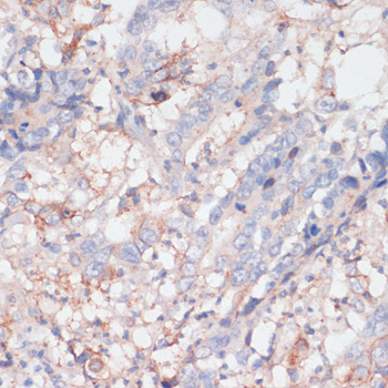 Immunohistochemistry - ZNRF3 Polyclonal Antibody 