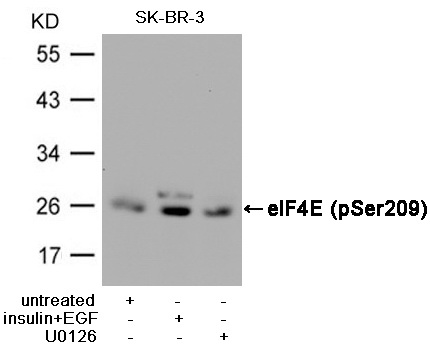 Western blot analysis of extracts from SK-BR-3 cells, untreated or insulin and EGF treated, and pretreated with U0126 cells, using eIF4E (Phospho-Ser209) Antibody .