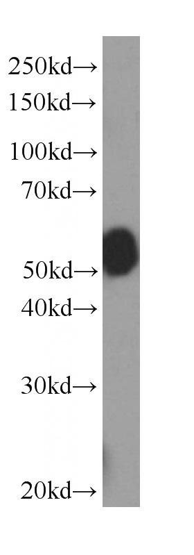 HEK-293 cells were subjected to SDS PAGE followed by western blot with Catalog No:107367(KMO Antibody) at dilution of 1:1000