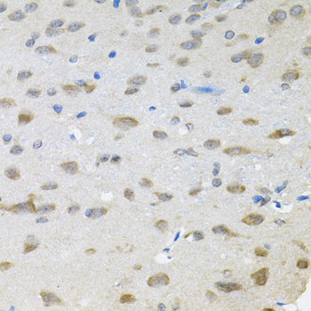 Immunohistochemistry - TRPC1 Polyclonal Antibody 