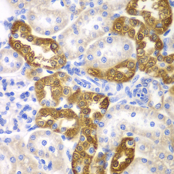 Immunohistochemistry - CD151 Polyclonal Antibody 