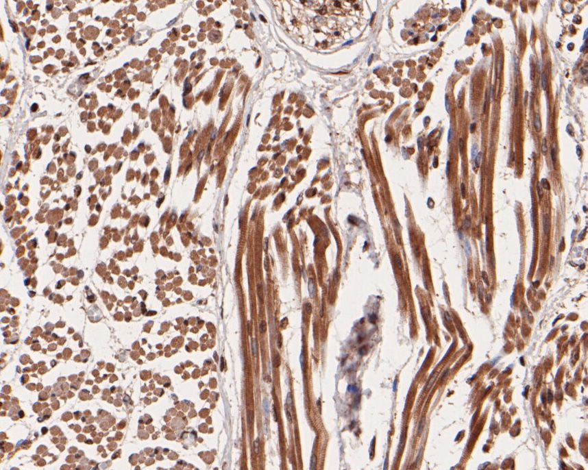 Fig3:; Immunohistochemical analysis of paraffin-embedded human skeletal muscle tissue using anti-Smg1 antibody. The section was pre-treated using heat mediated antigen retrieval with sodium citrate buffer (pH 6.0) for 20 minutes. The tissues were blocked in 5% BSA for 30 minutes at room temperature, washed with ddH; 2; O and PBS, and then probed with the primary antibody ( 1/400) for 30 minutes at room temperature. The detection was performed using an HRP conjugated compact polymer system. DAB was used as the chromogen. Tissues were counterstained with hematoxylin and mounted with DPX.