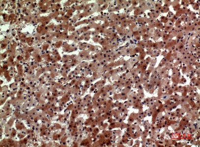Fig2:; Immunohistochemical analysis of paraffin-embedded human-liver, antibody was diluted at 1:100