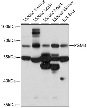 Western blot - PGM3 Polyclonal Antibody 