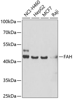Western blot - FAH Polyclonal Antibody 