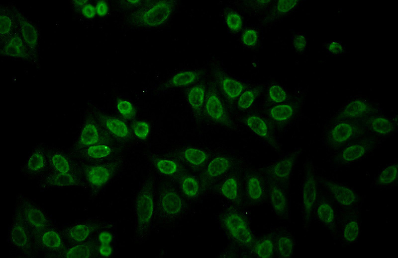 Immunofluorescent analysis of HepG2 cells using Catalog No:112577(MECP2 Antibody) at dilution of 1:50 and Alexa Fluor 488-congugated AffiniPure Goat Anti-Rabbit IgG(H+L)