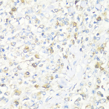 Immunohistochemistry - EIF3J Polyclonal Antibody 