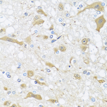 Immunohistochemistry - APOL1 Polyclonal Antibody 