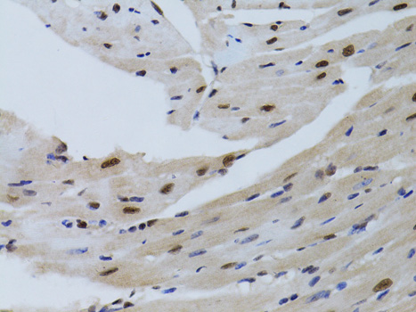 Immunohistochemistry - SIRT7 Polyclonal Antibody 