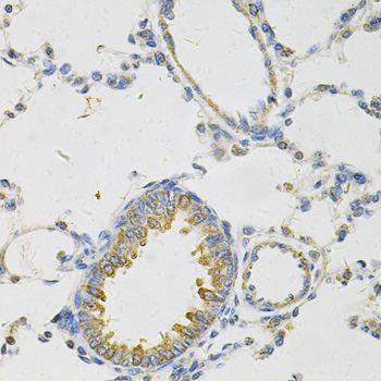 Immunohistochemistry - PON2 Polyclonal Antibody 