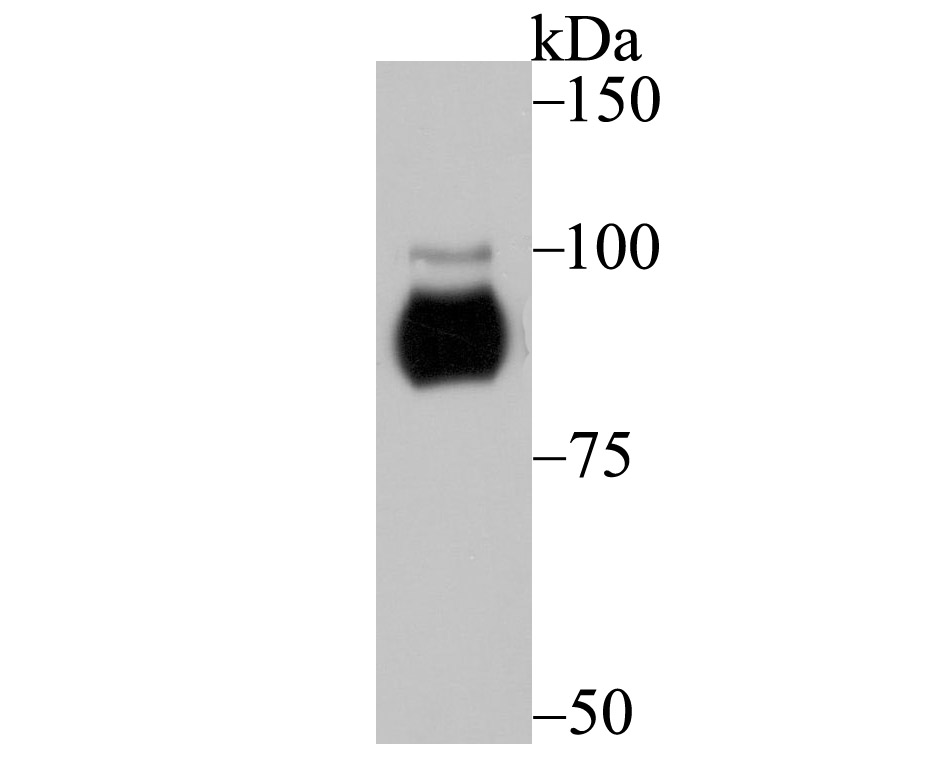 Fig1:; Western blot analysis of Protein Kinase D2 on A549 cell lysates. Proteins were transferred to a PVDF membrane and blocked with 5% BSA in PBS for 1 hour at room temperature. The primary antibody ( 1/500) was used in 5% BSA at room temperature for 2 hours. Goat Anti-Rabbit IgG - HRP Secondary Antibody (HA1001) at 1:200,000 dilution was used for 1 hour at room temperature.