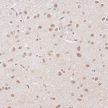Immunohistochemistry - CBX6 Polyclonal Antibody 