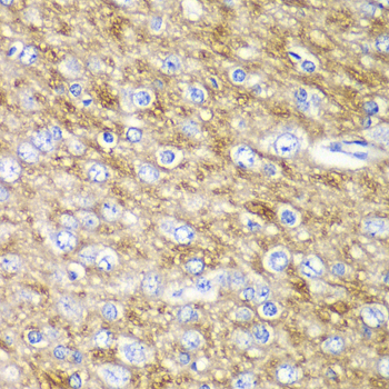 Immunohistochemistry - ARFGAP1 Polyclonal Antibody 