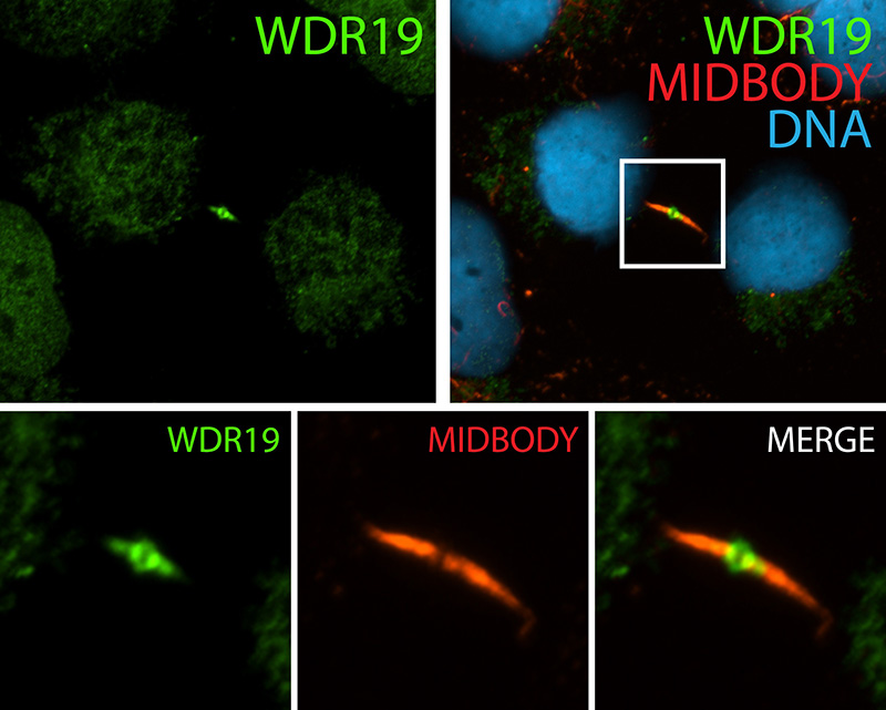 IF result (ocalization near the Fleming body) of anti-WDR19 (Catalog No:116858, 1:50) with telophase hTERT-RPE1 cells (MeOH fixed) by Dr. Moshe Kim.