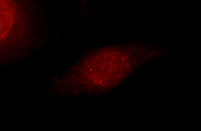 Immunofluorescent analysis of HeLa cells using Catalog No:113047(NCOR2 Antibody) at dilution of 1:25 and Rhodamine-Goat anti-Rabbit IgG