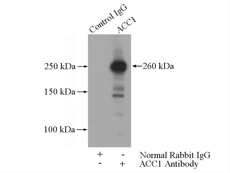 IP Result of anti-ACC (IP:Catalog No:107732, 5ug; Detection:Catalog No:107732 1:500) with HeLa cells lysate 2800ug.