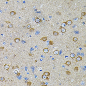 Immunohistochemistry - PFKP Polyclonal Antibody 