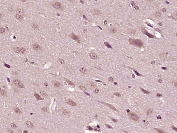 Fig2: Paraformaldehyde-fixed, paraffin embedded (rat brain tissue); Antigen retrieval by boiling in sodium citrate buffer (pH6.0) for 15min; Block endogenous peroxidase by 3% hydrogen peroxide for 20 minutes; Blocking buffer (normal goat serum) at 37℃ for 30min; Antibody incubation with (BMPER) Polyclonal Antibody, Unconjugated at 1:400 overnight at 4℃, followed by operating according to SP Kit(Rabbit) (sp-0023) instructionsand DAB staining.