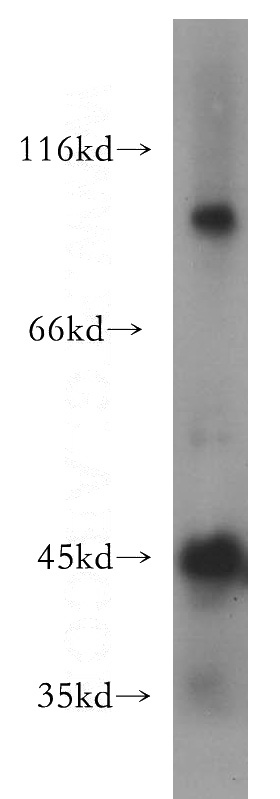 human testis tissue were subjected to SDS PAGE followed by western blot with Catalog No:107709(ACTL7B antibody) at dilution of 1:300
