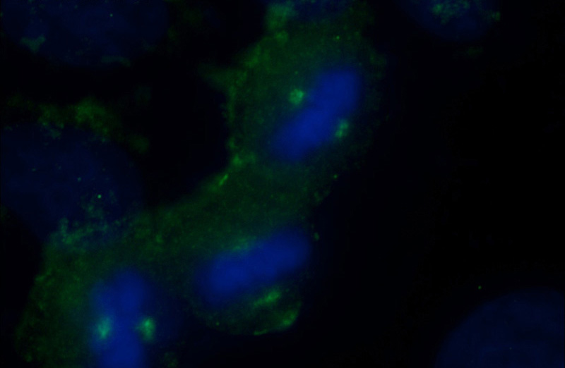 Immunofluorescent analysis of (-20oc Ethanol) fixed HeLa cells using Catalog No:111916(KATNB1 Antibody) at dilution of 1:50 and Alexa Fluor 488-congugated AffiniPure Goat Anti-Rabbit IgG(H+L)
