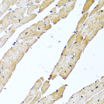 Immunohistochemistry - CALCB Polyclonal Antibody 
