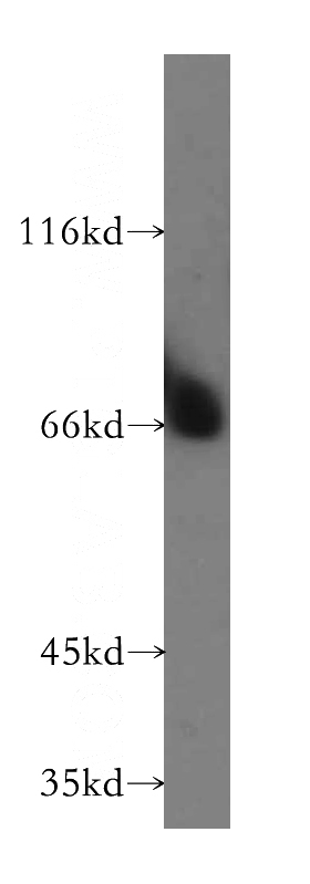 mouse testis tissue were subjected to SDS PAGE followed by western blot with Catalog No:116450(TXNDC3 antibody) at dilution of 1:1000