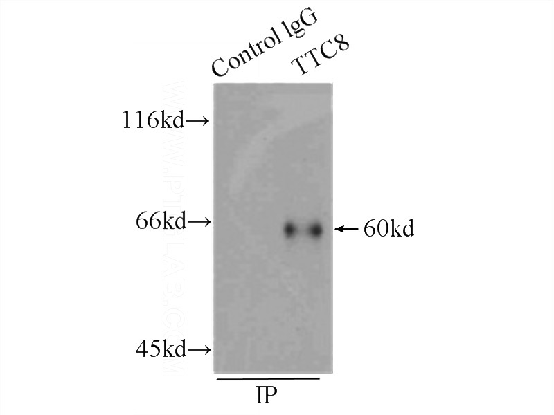 IP Result of anti-TTC8 (IP:Catalog No:108376, 3ug; Detection:Catalog No:108376 1:400) with HeLa cells lysate 2000ug.