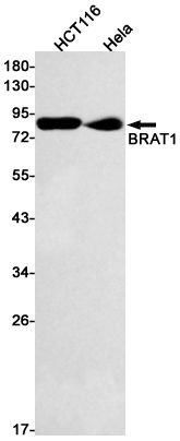 Western blot detection of BRAT1 in HCT116,Hela cell lysates using BRAT1 Rabbit mAb(1:1000 diluted).Predicted band size:88kDa.Observed band size:88kDa.