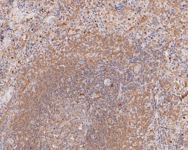 Fig3:; Immunohistochemical analysis of paraffin-embedded rat spleen tissue using anti-Themis antibody. The section was pre-treated using heat mediated antigen retrieval with sodium citrate buffer (pH 6.0) for 20 minutes. The tissues were blocked in 5% BSA for 30 minutes at room temperature, washed with ddH; 2; O and PBS, and then probed with the primary antibody ( 1/50) for 30 minutes at room temperature. The detection was performed using an HRP conjugated compact polymer system. DAB was used as the chromogen. Tissues were counterstained with hematoxylin and mounted with DPX.