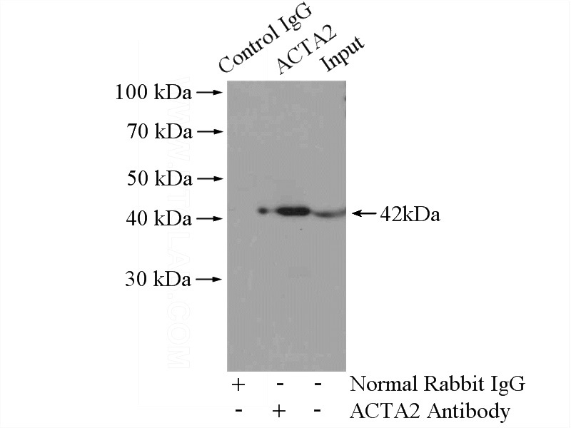 IP Result of anti-a-SMA specific (IP:Catalog No:107706, 4ug; Detection:Catalog No:107706 1:1000) with mouse heart tissue lysate 3200ug.