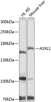 Western blot - ASXL1 Polyclonal Antibody 