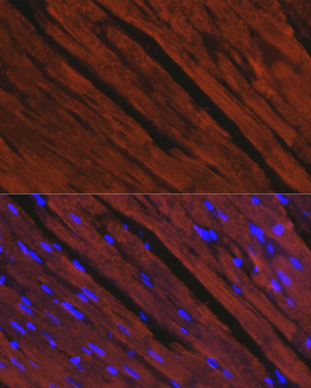 Immunofluorescence - MYH6 Polyclonal Antibody 