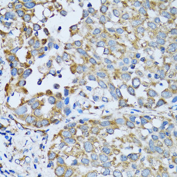 Immunohistochemistry - RARS Polyclonal Antibody 