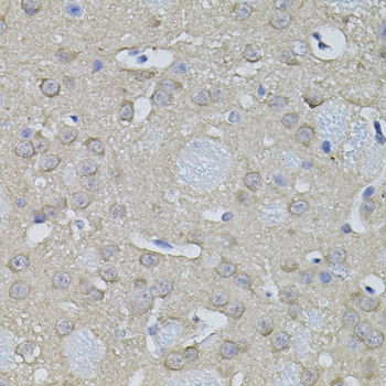 Immunohistochemistry - ACO1 Polyclonal Antibody 