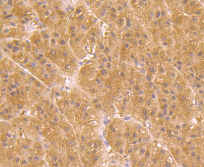Fig3: Immunohistochemical analysis of paraffin-embedded human liver tissue using anti-UGP2 antibody. Counter stained with hematoxylin.