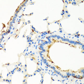 Immunohistochemistry - RGS5 Polyclonal Antibody 