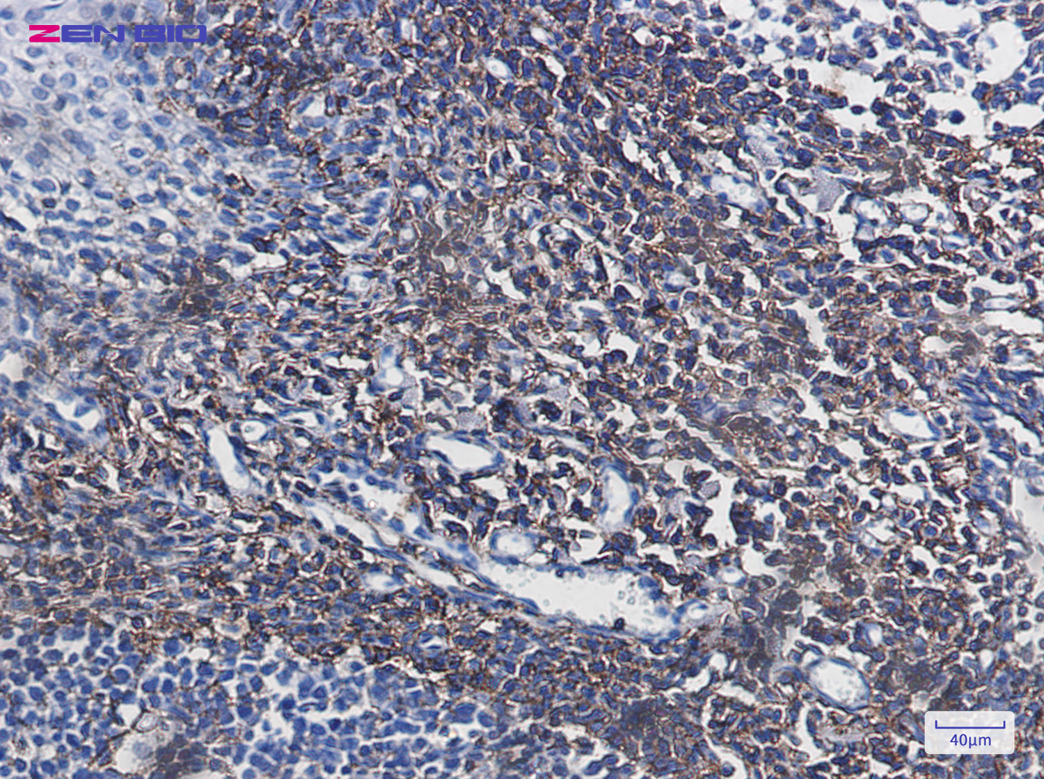 Immunohistochemistry of CD44 in paraffin-embedded Human tonsil using CD44 Rabbit pAb at dilution 1/20